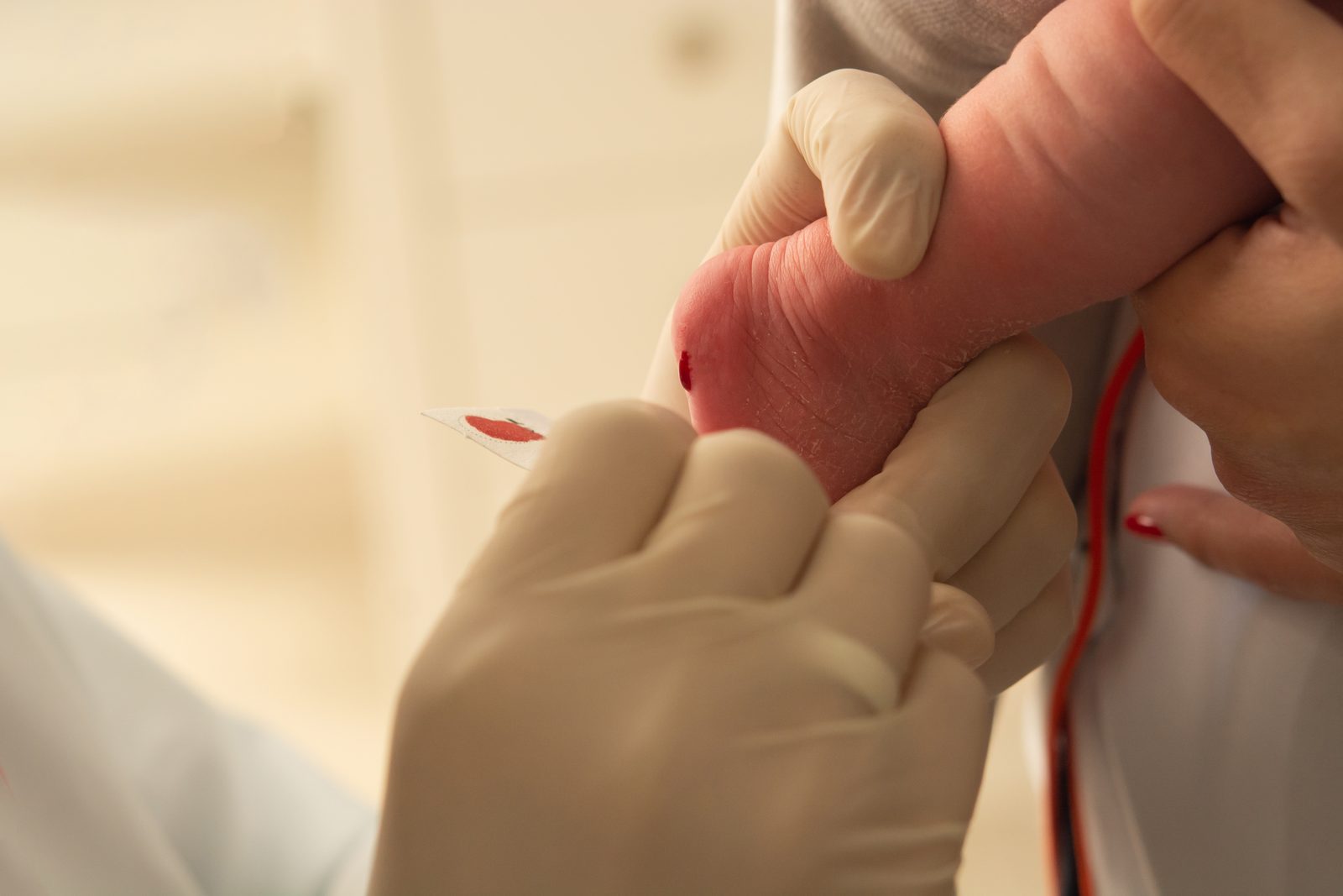 醫護人員為新生兒腳跟採血做篩檢的特寫